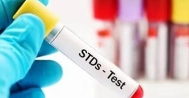 Sexually Transmitted Infections on 'Troubling' Rise in Europe