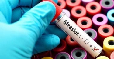 Samoa Measles